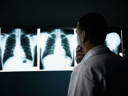 Male doctor at work in public medical clinic and examining x-ray plates of bones, skull and lungs
