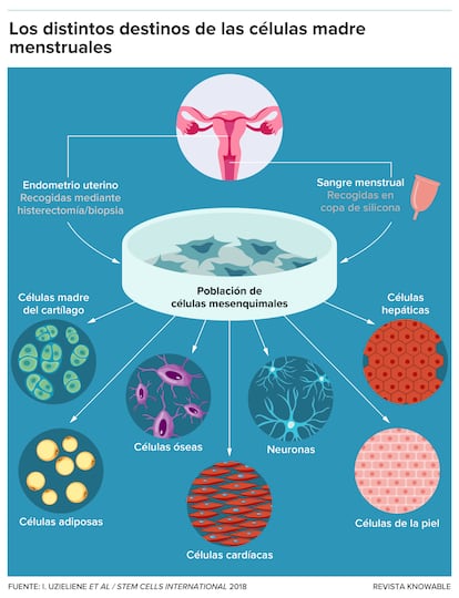 Las células madre del endometrio pueden obtenerse mediante una biopsia o en la sangre menstrual.