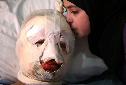 Un coche bomba explotó cerca de una gasolinera en Hermel, una localidad libanesa que está a 10 kilómetros de la frontera siria, matando a varias personas. Ahmad al-Messmar, de 40 años, resultó gravemente herido. Su hija Fátima, de 13 años, besa llorosa a su padre, que tiene la cabeza completamente vendada.