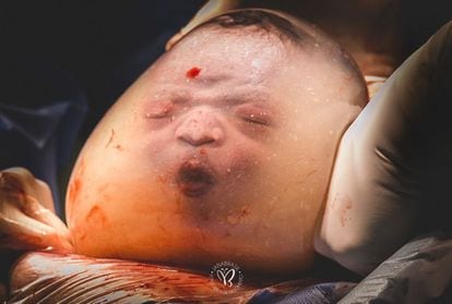 'Baby Noah Empelicado', de Brasil. Esta sorprendente imagen ha sido la primera en la categoría de 'Detalles del parto'. Un parto empelicado es el nacimiento de un bebé en su saco amniótico, algo que ocurre en uno entre 80.000 nacimientos.