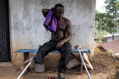 Sheku Turay descansa después de subir la montaña hasta su casa en Freetown. Sheku tiene una prótesis en la pierna, pero no puede usarla en los caminos y senderos accidentados para llegar a su casa. 
Solo tenía 12 años cuando los rebeldes atacaron su pueblo, en el distrito norteño de Tonkolili, durante la guerra civil que dejó decenas de miles de muertos entre 1991 y 2002. 
Los médicos sacrificaron su pierna para salvarla de la gangrena.  Como muchos otros, ha encontrado un apoyo muy necesario y una nueva oportunidad en la vida a través de su equipo de futbolistas amputados.
 
