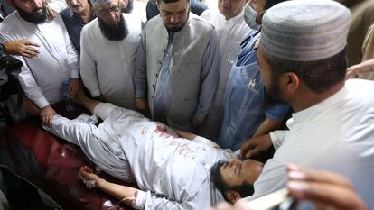 Un herido en el atentado en Jar, en Pakistán, este domingo.