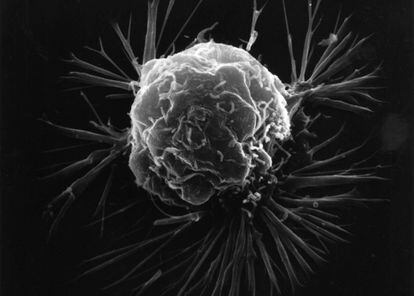 Una célula de cáncer de mama vista con microscopio electrónico.