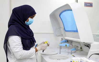 La técnica de laboratorio Wardo Abdalla trabaja dentro del Laboratorio de Diagnóstico de Medipark que realiza pruebas para la covid-19, en Mogadiscio, Somalia, el 14 de octubre de 2020.