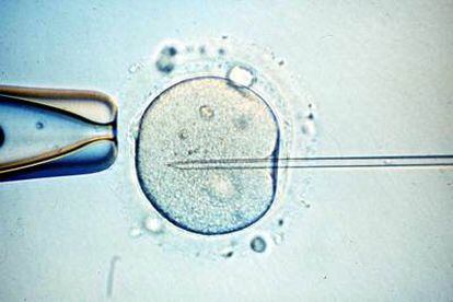 Fecundación in vitro de un óvulo mediante microinyección de esperma.