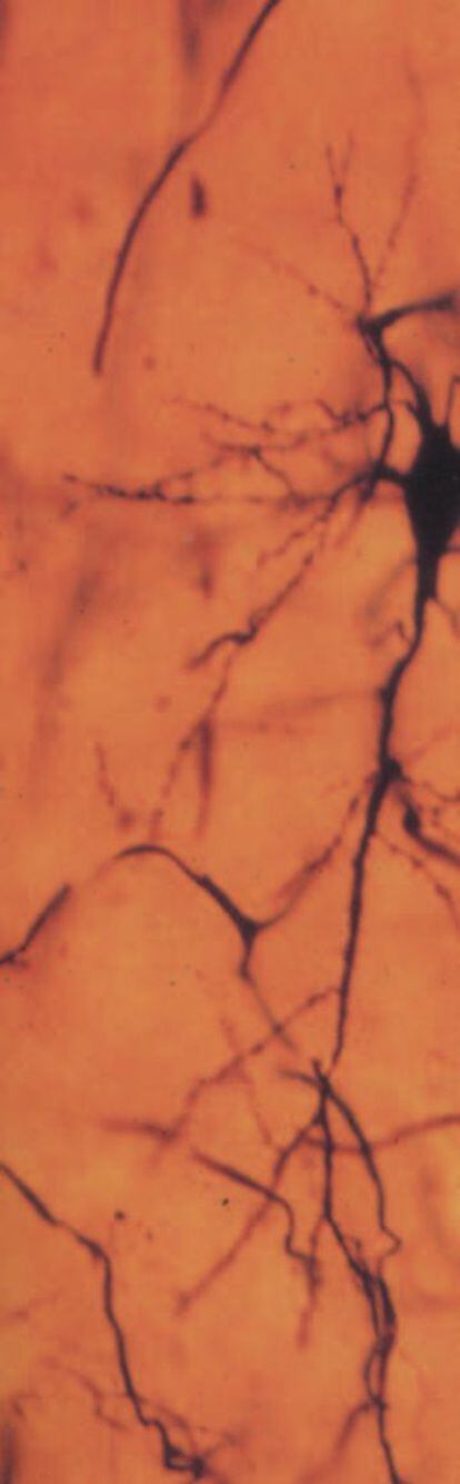 Microfotografía realizada por Cajal que muestra una sección de corteza cerebral en la que pueden apreciarse las células nerviosas.