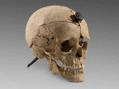 Cráneo de guerrero íbero atravesado por un clavo de hierro.