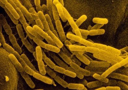 La bacteria 'bacillus cereus', una de las implicadas en la transferencia genética.