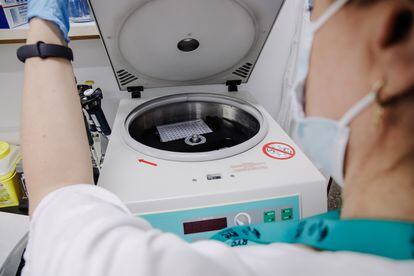 Una enfermera del Hospital Ramón y Cajal en Madrid preparaba el 30 de mayo una prueba PCR para la detección de la viruela del mono.