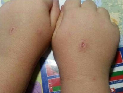 Imagen de las manos del niño de ocho años de Mieres, víctima del 'Abecedario del Diablo'.