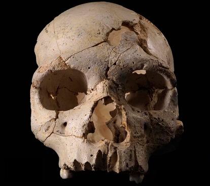 Cráneo número 5 de la Sima de los Huesos, apodado 'Miguelón'.