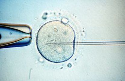 Microinyección de esperma en un óvulo.
