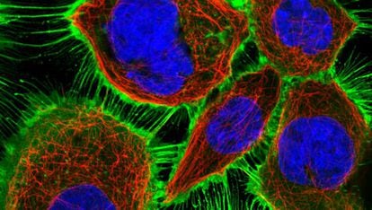 El receptor del factor de crecimiento epidérmico (EGFR), en verde; el esqueleto celular, en rojo, y el material genético del núcleo, en azul.