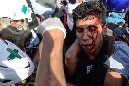 Un herido es atendido por los servicios sanitarios durante las protestas.