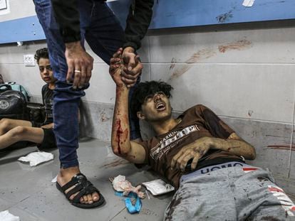 Palestinos heridos en un pasillo del hospital Al Shifa, este martes.