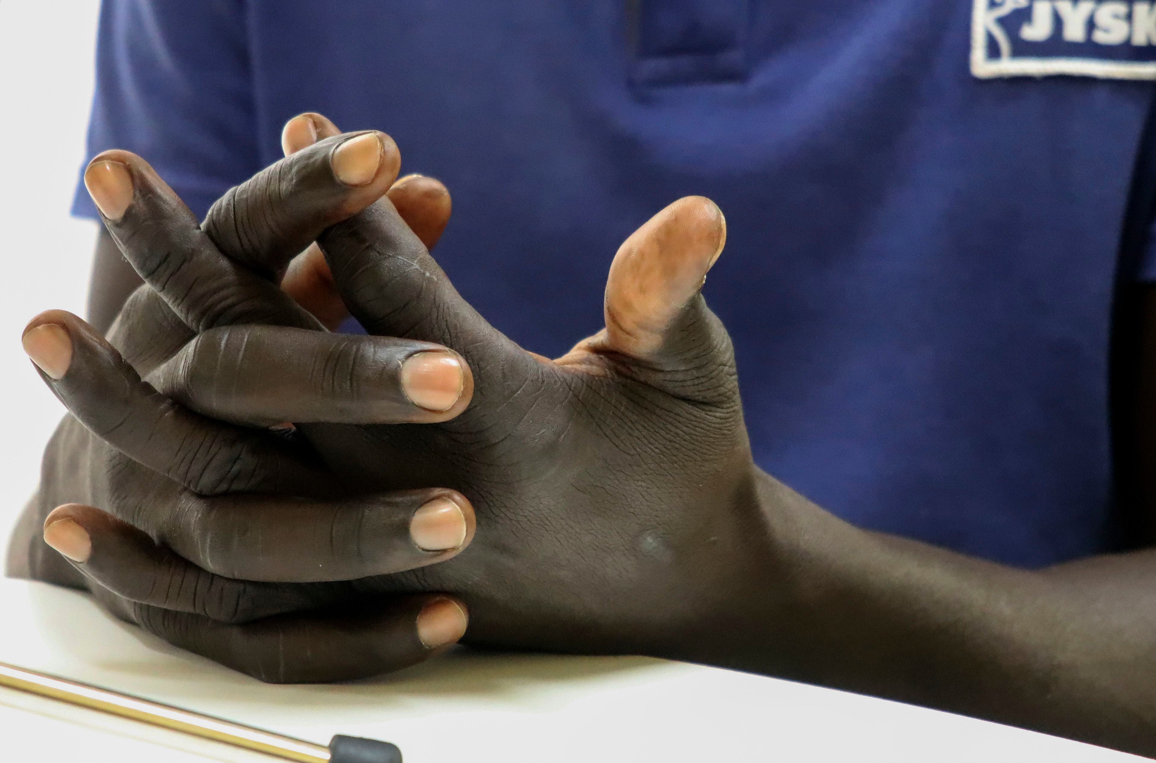 Vista de las manos de Basir (nombre ficticio), refugiado sudanés que ha pedido asilo en la Embajada española en Marruecos, el martes en Rabat,