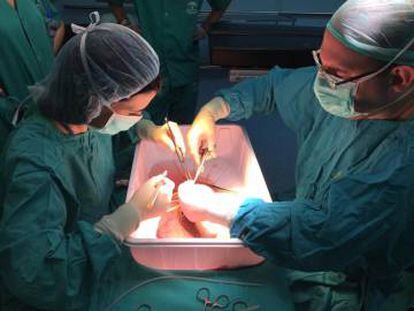 Médicos de la Unidad de Cirugía del Hospital Reina Sofía operan un hígado.