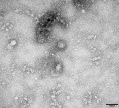 Imagen al microscopio del primer caso aislado de este coronavirus, en enero de 2020.