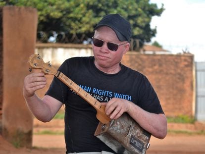 El músico albino Lazarus Chigwandali, con su banjo en su casa de Lilongwe.