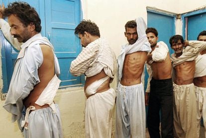 Varios paquistaníes muestran las cicatrices de la extracción de uno de sus riñones en una clínica clandestina y clausurada por la policía.