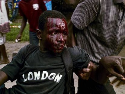 Un manifestante herido tras choques con la polic&iacute;a