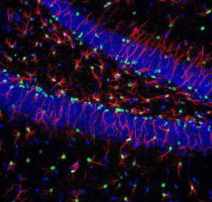 Tejido cerebral al microscopio, con el núcleo de las células madre en verde, el de las demás células en azul y un subgrupo de células madre neuronales en rojo.