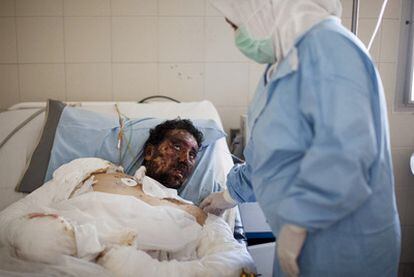 Un combatiente rebelde se recupera de sus heridas en el hospital de Bengasi.