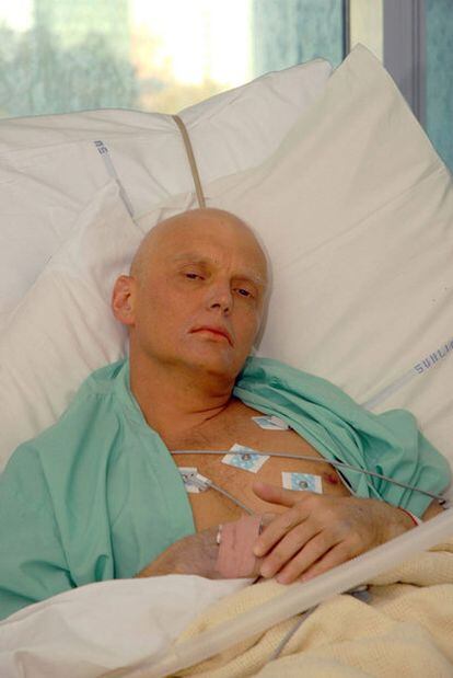 Litvinenko en estado crítico en el hospital tras ser envenenado.