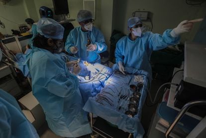 Médicos realizan una cirugía endoscópica en un paciente con mucormicosis en India, el pasado 3 de junio.