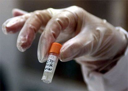 Un vial de vacuna de viruela en Israel, donde se ha autorizado la inoculación de miles de personas.
