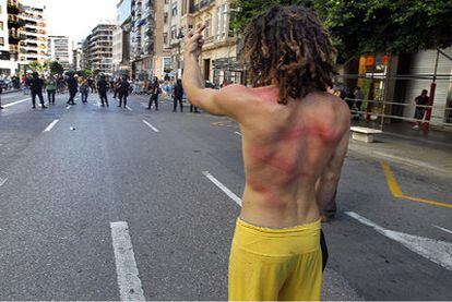 Un manifestante, con la espalda llena de contusiones por porrazos de los agentes, reta a la policía en Valencia.