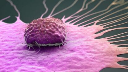 El sismólogo que diagnostica el cáncer de mama con ultrasonidos