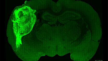 Un organoide cerebral humano, marcado con una proteína fluorescente y trasplantado al cerebro de una rata.