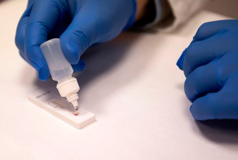 Un trabajador médico realiza una prueba serológica rápida de anticuerpos para COVID-19