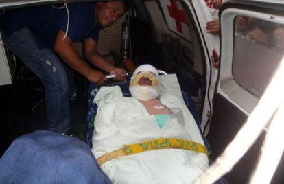 El periodista boliviano Fernando Vidal, tras la agresión del pasado lunes