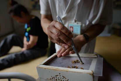 La medicina tradicional xinesa utilitza agullons d'abella contra el càncer.