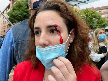 La diputada de Vox Rocío de Meer ha resultado herida al recibir una pedrada antes del mitin del partido en Sestao (Vizcaya)
VOX
26/06/2020