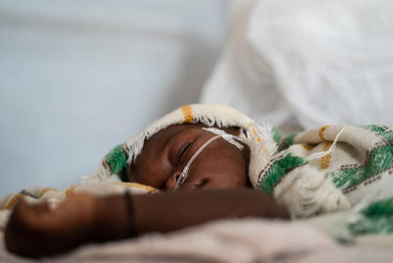 Un niño con complicaciones respiratorias en el Chad, África, a mediados de abril de 2020.