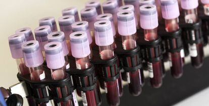 Muestras de sangre en un tubo de ensayo de un laboratorio.