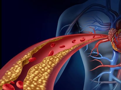 ¿Cuándo usar un fármaco para bajar el colesterol?