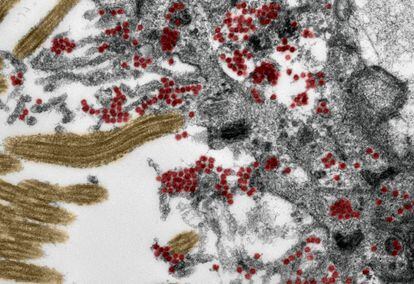 En esta sección de una célula de la mucosa olfativa vista al microscopio electrónico se observan en rojo las partículas del coronavirus (el color no es real).