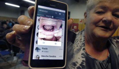 Josefa García muestra una fotografía de su boca sin dientes tras el cierre de Funnydent.