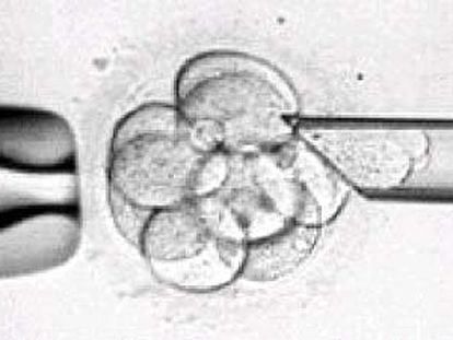 Manipulación en laboratorio de un embrión humano.