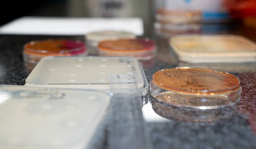 Laboratorio de microbiología del hospital de MSF en Amán en el que se analiza la resistencia a los antibióticos de algunas bacterias.