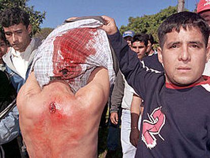 Un hombre muestra las heridas sufridas por otro en las protestas.