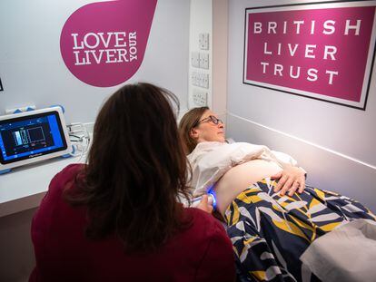 Unidad móvil de escaneo hepático del British Liver Trust en el Congreso Internacional del Hígado, celebrado en junio en Londres.