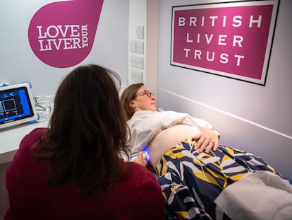 Unidad móvil de escaneo hepático del British Liver Trust en el Congreso Internacional del Hígado, celebrado en junio en Londres.