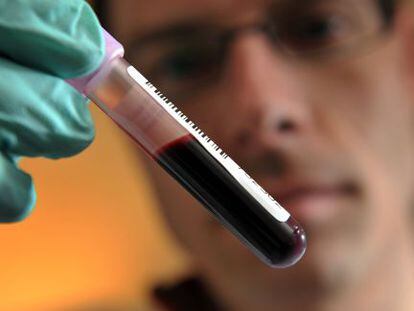 El test consiste en detectar la evolución de la presencia de una proteína en la sangre.