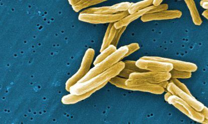 Bacteria de la tuberculosis, vista a través de un microscopio.