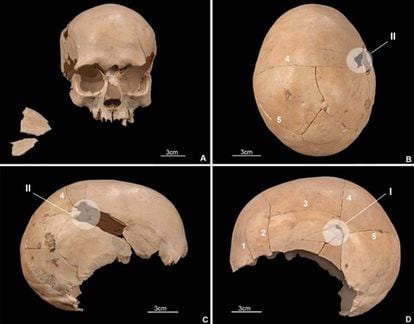 Cráneo de uno de los individuos asesinados en la cueva de Els Trocs, con impactos de flechas y objetos contundentes.